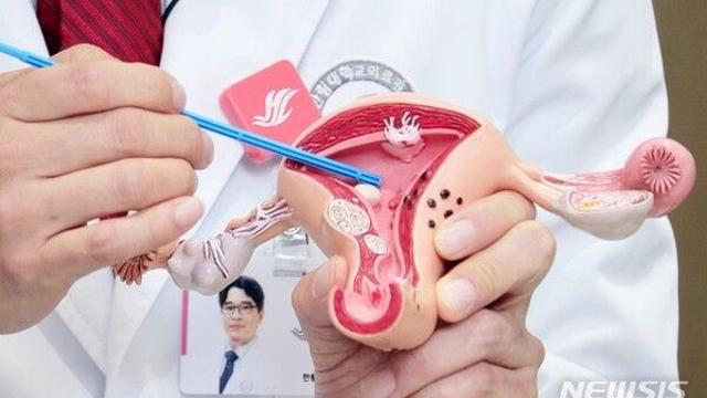 자궁경부암 전 단계인 '이 질환'…