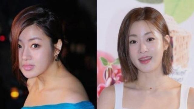 드디어 거북목 교정계의 전설 등판 ㄷㄷ
