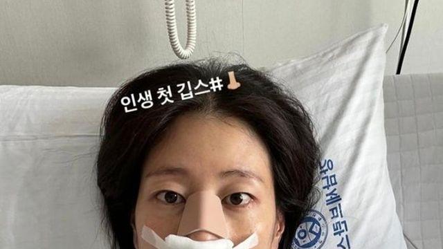 이현이, ‘골때녀’ 경기 중 코뼈 골절