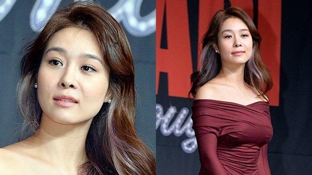 “억만금 있어도”…옥주현, 탈모→모발이식 부작용 고백 [RE:뷰]