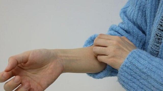 환절기에 찾아오는 '각질 폭탄'…방치하면 후회하는 이유