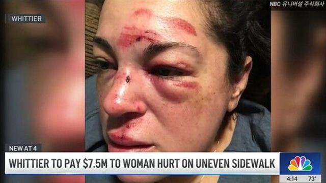 보도블록서 넘어져 뇌손상입은 美여성…106억원 보상금 받아내