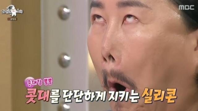 [TVis] 조째즈 “성형 1세대, 눈 코 다 했다” (‘라디오스타’)