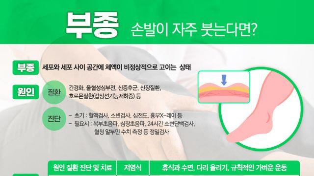 손·발이 자주 붓는다면? 신장·심장 질환 신호일 수도 있어