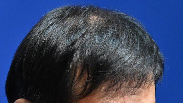 뛰는 집값에 멈춘 금리인하…다음 인하 시점은