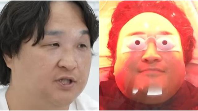 구성환이 앓고 있는 피부병…