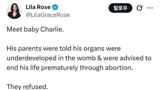 와들와들 미국에서 난리난 기형아 출산.JPG