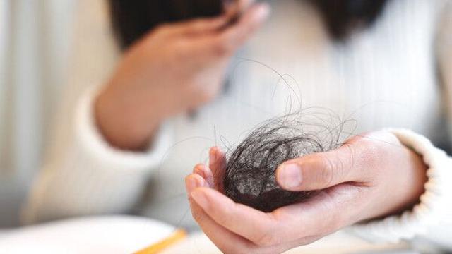 “가을철에 머리카락 더 빠진다