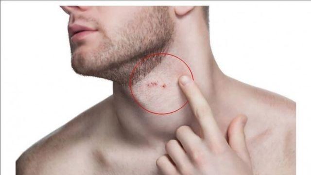 면도기회사 질레트의 탄생과정 JPG