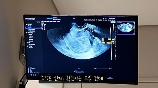 난임 진단 받자마자 임신했던 유명 커플 '걱정스런' 소식 전했다
