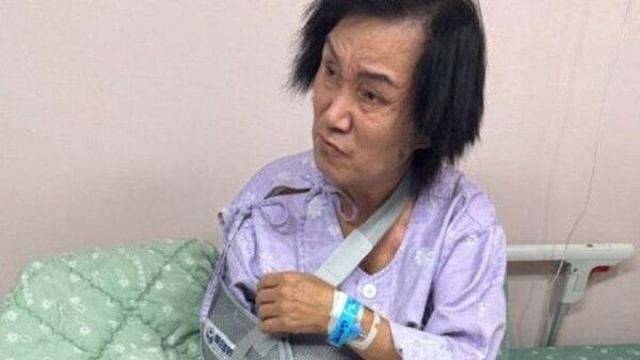 '신바람' 이박사, 어깨 골절로 철심 수술…생활고까지