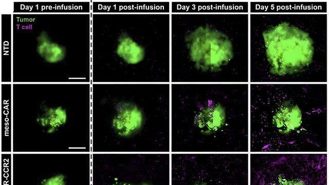 체외 미세 칩으로 폐암 등 고형암 치료 효과 예측한다