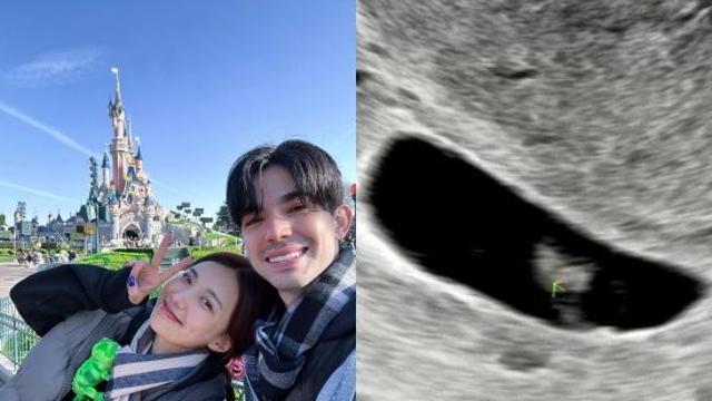 로빈♥김서연, 수술하러 갔는데 아기 심장 뛰어…