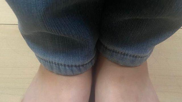 여름만 되면 아이들에게 보이는 피부병.