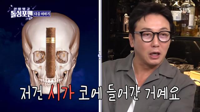 박소영 성형코에 탁재훈 “시가 넣었냐?”…신봉선, 입 때렸다
