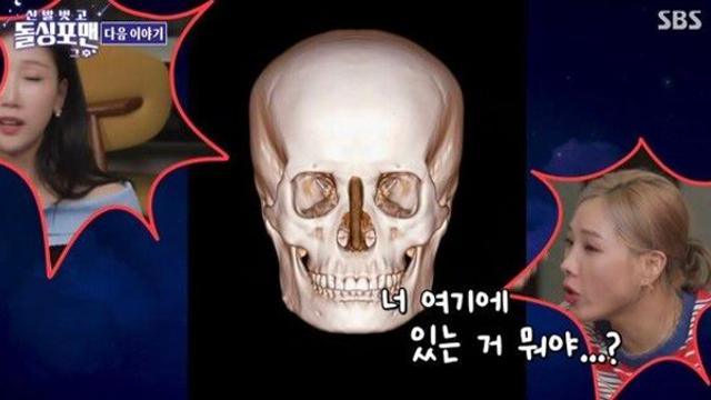 박소영, 코 성형수술 실리콘 충격…탁재훈 