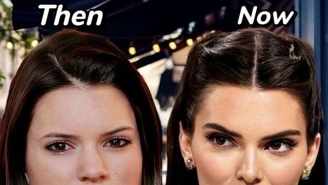 켄달 제너 성형 전&후 비교