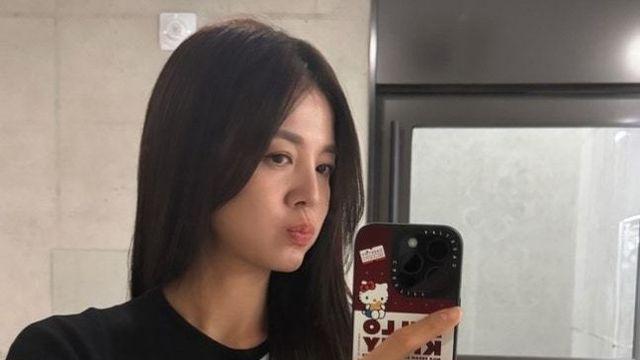 김성은, 팔 부상 당해 깁스… “친구들이 씻겨줘”