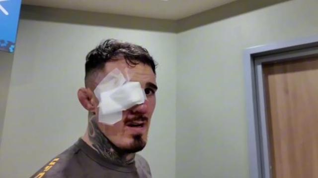 '시력 잃은' 아스피날 또 저격!…'도망자' 존 존스, 안대 쓴 말 타고 등장→'선 넘은 조롱' 논란