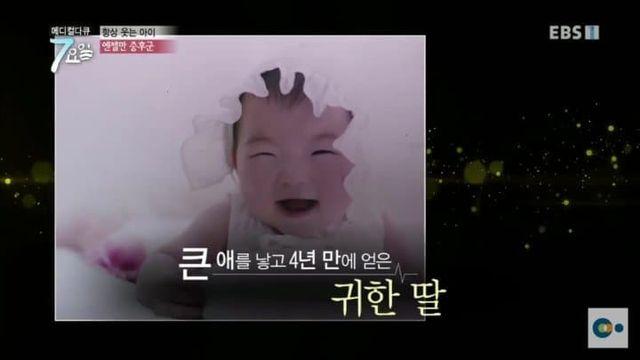 평생 웃으면서 사는병 엔젤만증후군