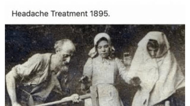 회복률 100%였던 130년전 두통 치료법 ㅎㄷㄷ