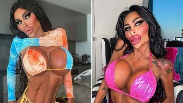 '인간 바비' 원한 성형 중독 여성…충격적 비주얼