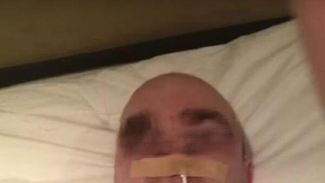 충전선 코에 꽂고 '암 환자 행세'…스포츠 영웅의 몰락