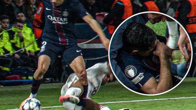 살인태클로 상대 발목 작살내놓고 퇴장 받으니 웃은 디아스...하키미는 3~5주 결장 예상