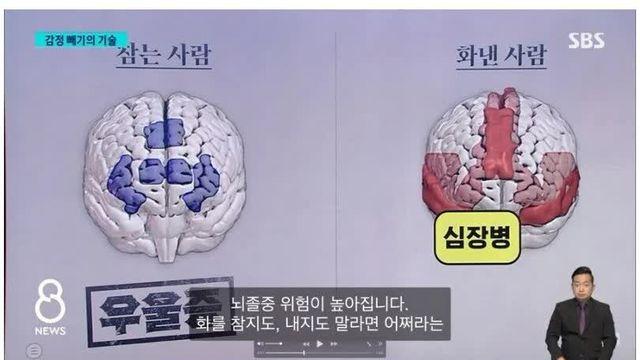 화를 참는 사람 뇌 v 화를 내는 사람 뇌