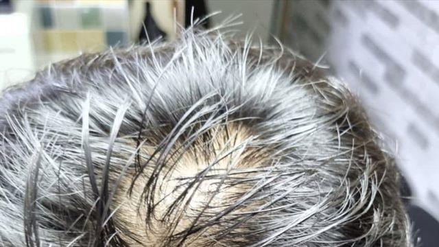 헤드폰 탈모영향 있는것같음 [혐주의]