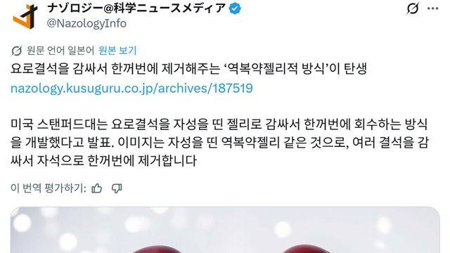 새로운 요로결석 치료 방법