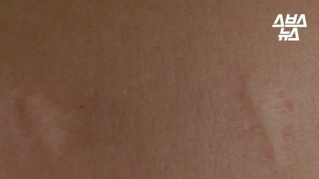 전국민 커플 주사.jpg