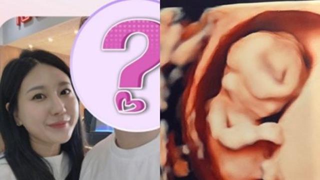 28기 정숙, '나솔이' 성별·혼전임신 심경 밝혔다…