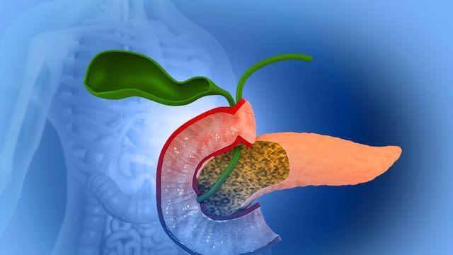 췌장암, 낮은 생존율로 ‘침묵의 암’이라 불리는 이유는?