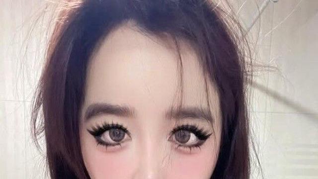 '치료 중' 박봄, 고소장 논란 후 근황…달라진 얼굴 깜짝