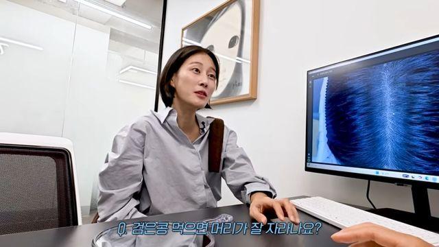 가르마가 휑한데 모발 이식 할까요? 이현이가 만난 탈모 전문의 '한상보'의 조언