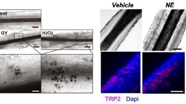 흰머리, 단순한 노화가 아닌 ‘암 방어 신호’일 수도