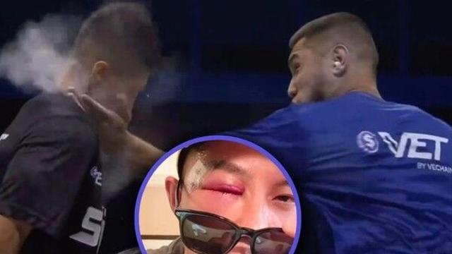 中전통 무술 '통배권' 계승자…'따귀 대회'서 광대뼈 골절