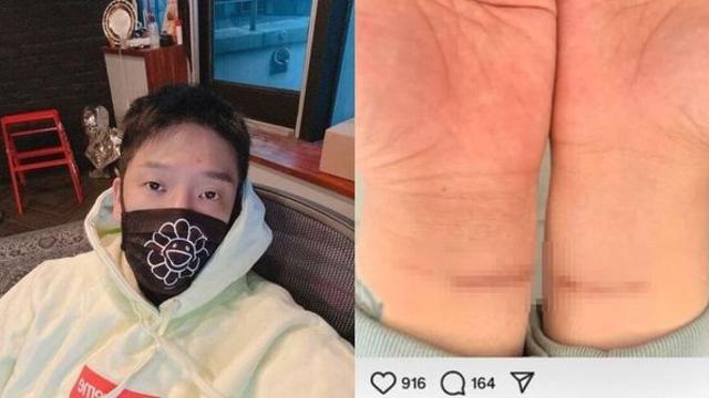 MC몽, 병역 기피 논란 분노→자해 사진까지 공개 