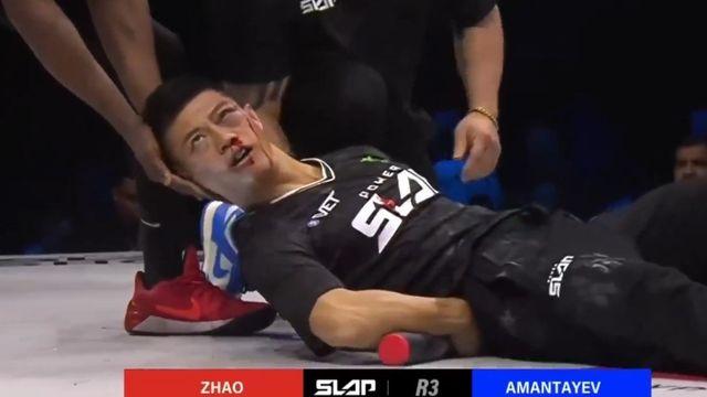 中 전통무술 계승자, 따귀 한방에 광대뼈 골절 ‘망신’