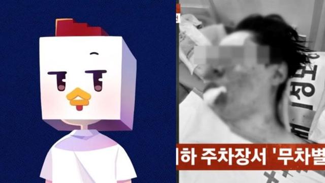 ‘납치·폭행’ 당해 얼굴 골절…‘100만 유튜버’ 수탉 “이대로 죽나 싶었다” [왓IS]