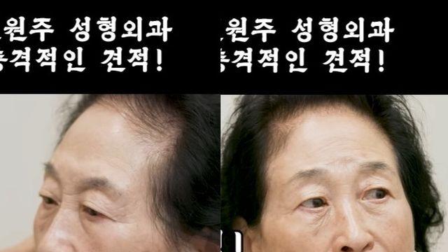 '건강이상설 해명' 전원주, 안면 거상+쌍커풀+코 성형? 