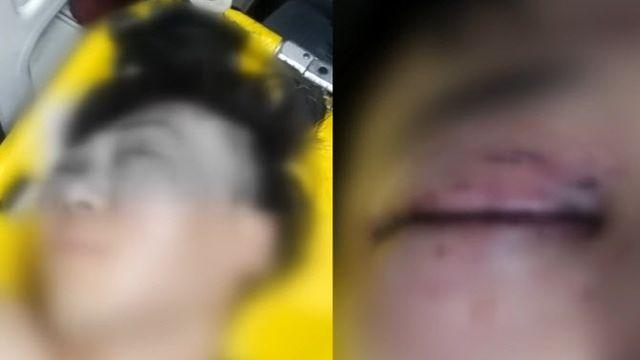 “살려주세요” 애원에도…“알게 뭐냐” 행인 목 조른 20대