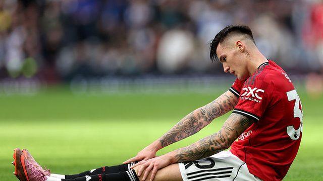 골도 못 넣는데 부상 입으면 최악...1290억 맨유 FW, 다행히 장기 부상 아니다!