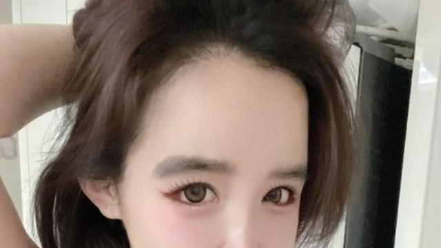 ‘치료 중’ 박봄 근황 공개…”갑자기 오늘을 기념하며”