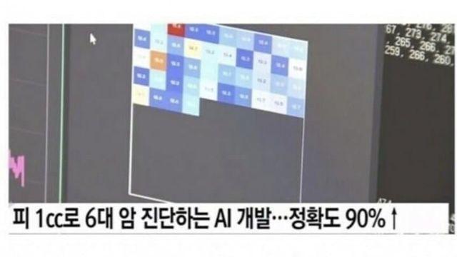 AI 의사 근황