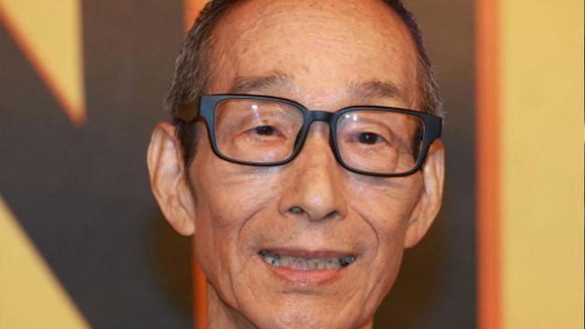 ‘대장암 극복’ 국민 男스타, 뇌경색으로 쓰러져…’대퇴골 골절’ 중상 [룩@글로벌]