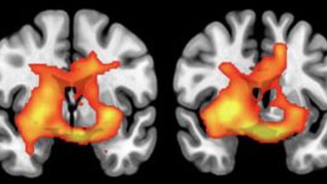 “가구 소득에 따라서 뇌 활동도 달라진다”