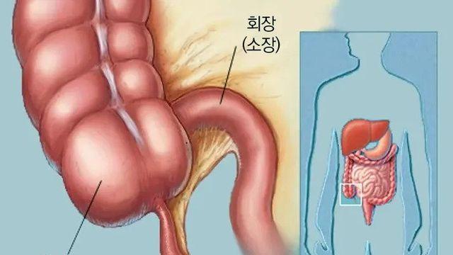 제거하면 단점보다 장점이 훨씬 많은 기관 