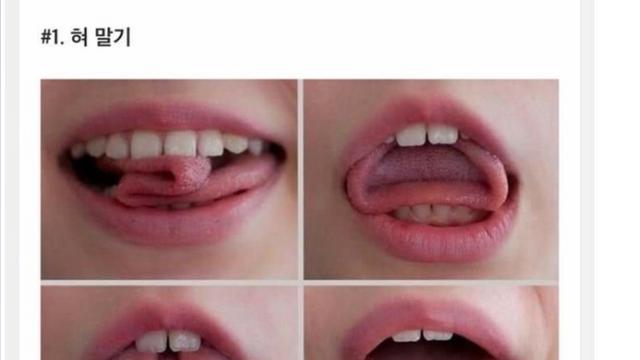 희귀성으로보는 인체의 신비.